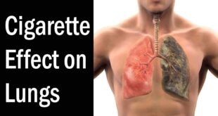 Cigarette Effect on Lungs