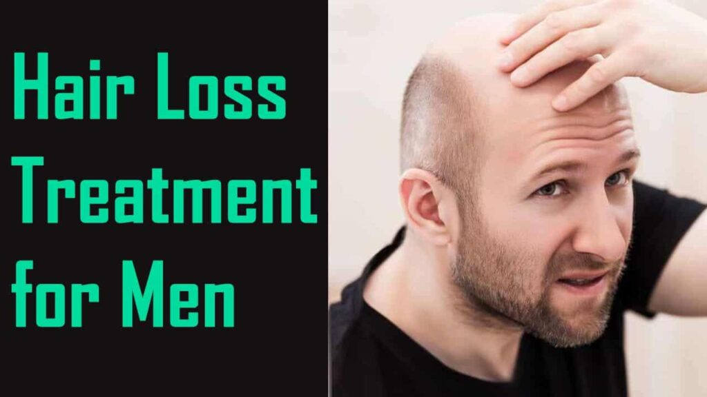 Hair Loss Treatment For Men 1024x576 