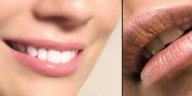 Home Remedies For Dark Lips Best Tips For Lips Care Naturally