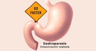 Home Remedies for Gastroparesis