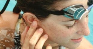 Home Remedies for Swimmers Ear